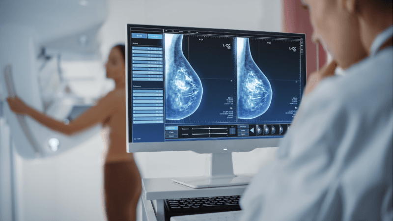 Dépistage, prévention des cancers du sein et des lésions mammaires à risque