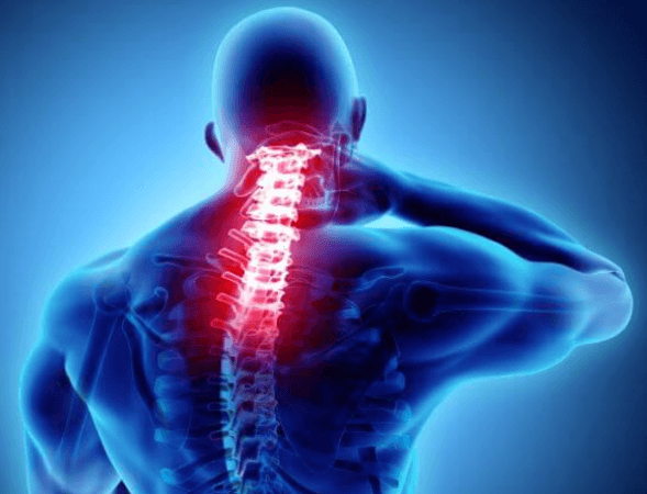 Démarche diagnostique en Médecine Générale devant une douleur du rachis cervical.